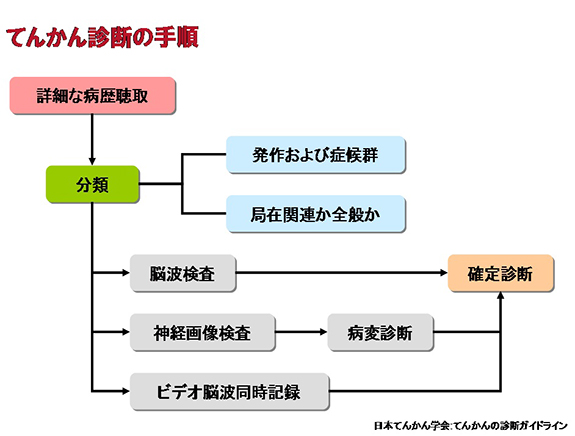 てんかんについて