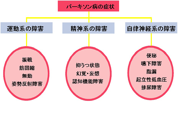 パーキンソン病について