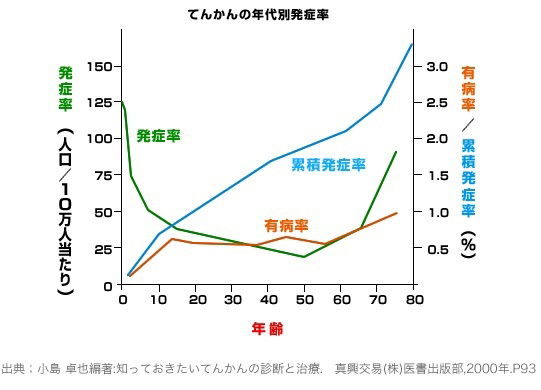 てんかんについて