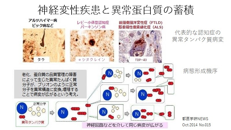 神経変性疾患と異常蛋白質の蓄積